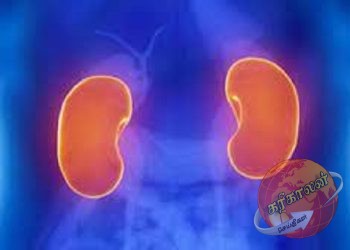 சிறுநீரகங்களைப் பெற்றுக் கொள்வதற்காக வறிய மக்களை ஏமாற்றி பண மோசடியில் ஈடுபட்ட மேலும் ஒருவர் கைது செய்யப்பட்டுள்ளார்.Karihaalan News