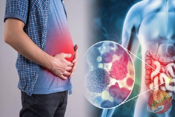 உங்க வயித்துல இந்த அறிகுறிகள் இருக்கா? அப்போ ஆபத்து நிச்சயம்!