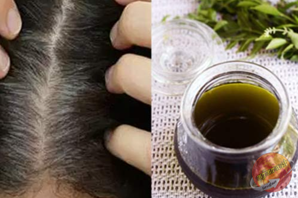 வெள்ளை முடிக்கு நிரந்தர தீர்வு வேண்டுமா? அப்போ இந்த பேக் போடுங்க!