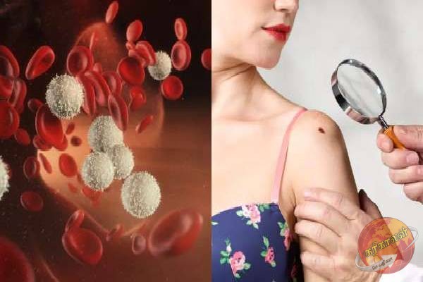 புற்றுநோய் ஏன் ஏற்படுகிறது? எவ்வாறு தடுக்கலாம் கட்டாயம் தெரிஞ்சிக்கோங்க