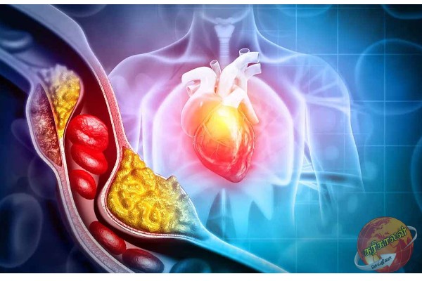 உடலில் கெட்ட கொழுப்பை கரைக்கும் கஷாயம்: தயாரிப்பது இவ்வளவு எளிதா?