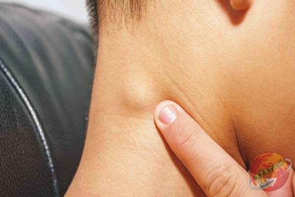 சிறுநீரக புற்றுநோயாளர்களின் கழுத்தில் தெரியும் அறிகுறிகள்- உங்களுக்கும் இருக்கா?