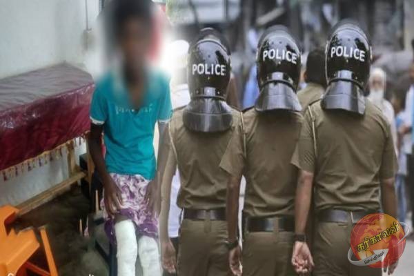 சிங்களப் பாடசாலையில் தமிழ் மாணவன் தீ வைத்து எரிப்பு ; நடவடிக்கை எடுக்காத பொலிஸார்